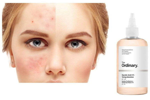 تونر لایه بردار و روشن کننده پوست اوردینری مدل Glycolic Acid 7%